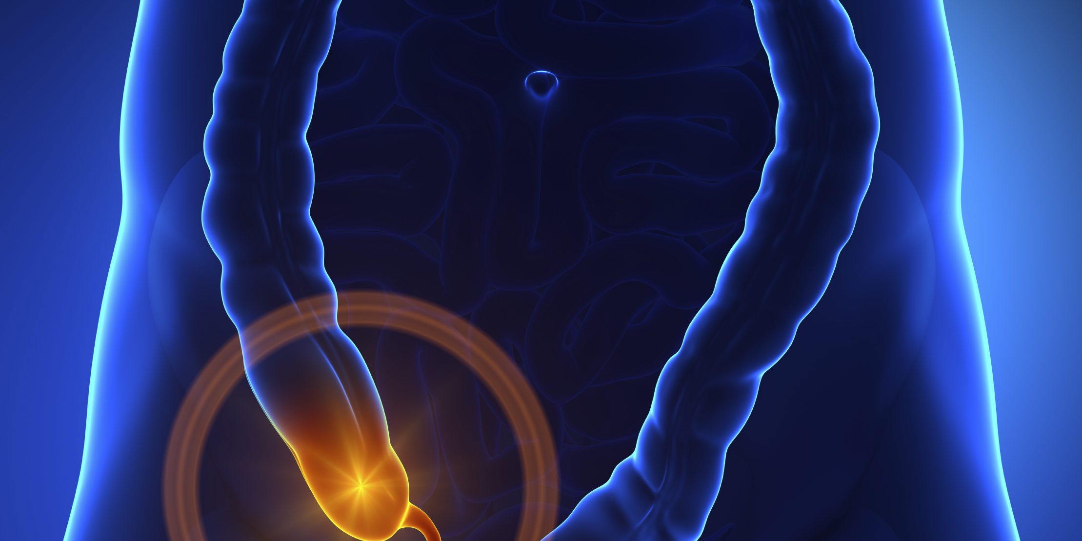 appendix appendicitis appendix appendicitis