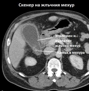 a9271f31d3dff7dec45c58ec4e24d2_big_gallery