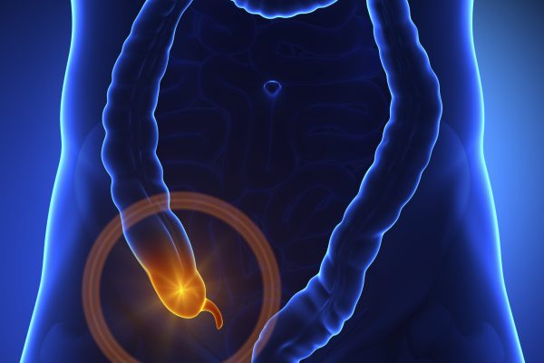 appendix-appendicitis