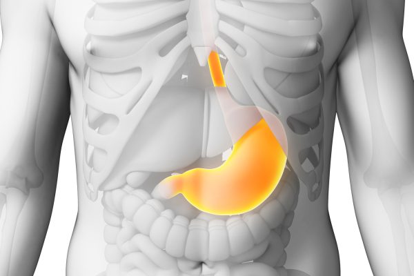 stomach-ulcer-diet281